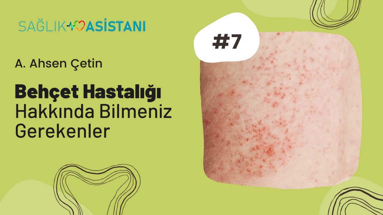 Behçet Hastalığı Hakkında Bilmeniz Gerekenler