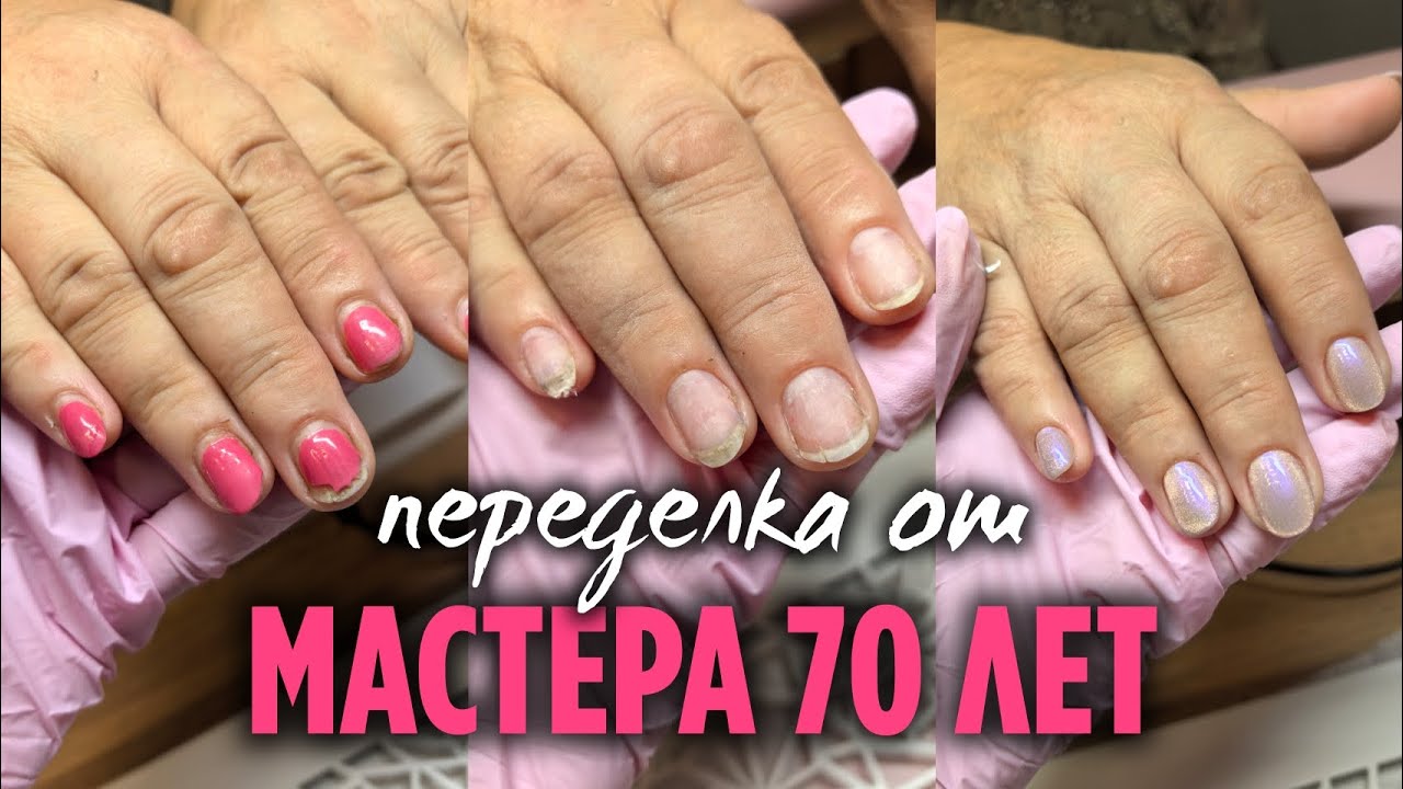 Отслоился свободный край | Коррекция на коротких ногтях, как не навредить  Маникюр до / после