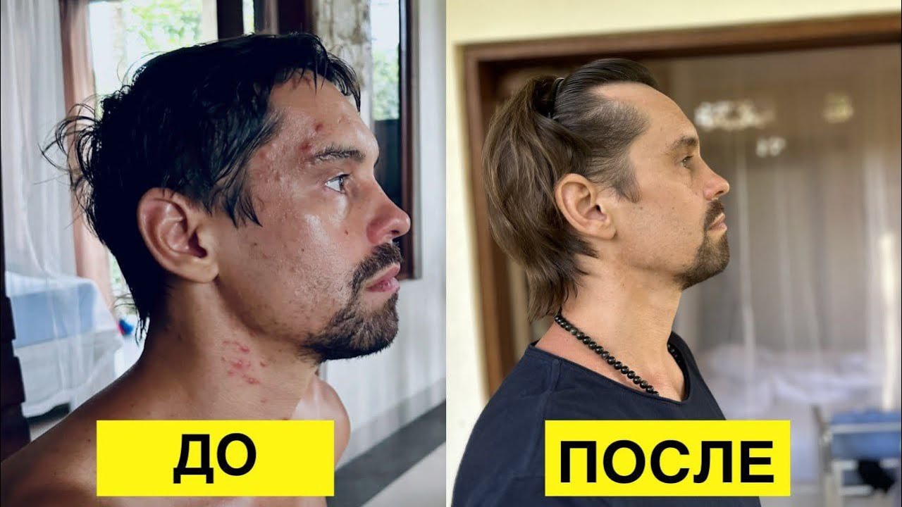 Убери внутреннее воспаление за 21 день. Решение. 