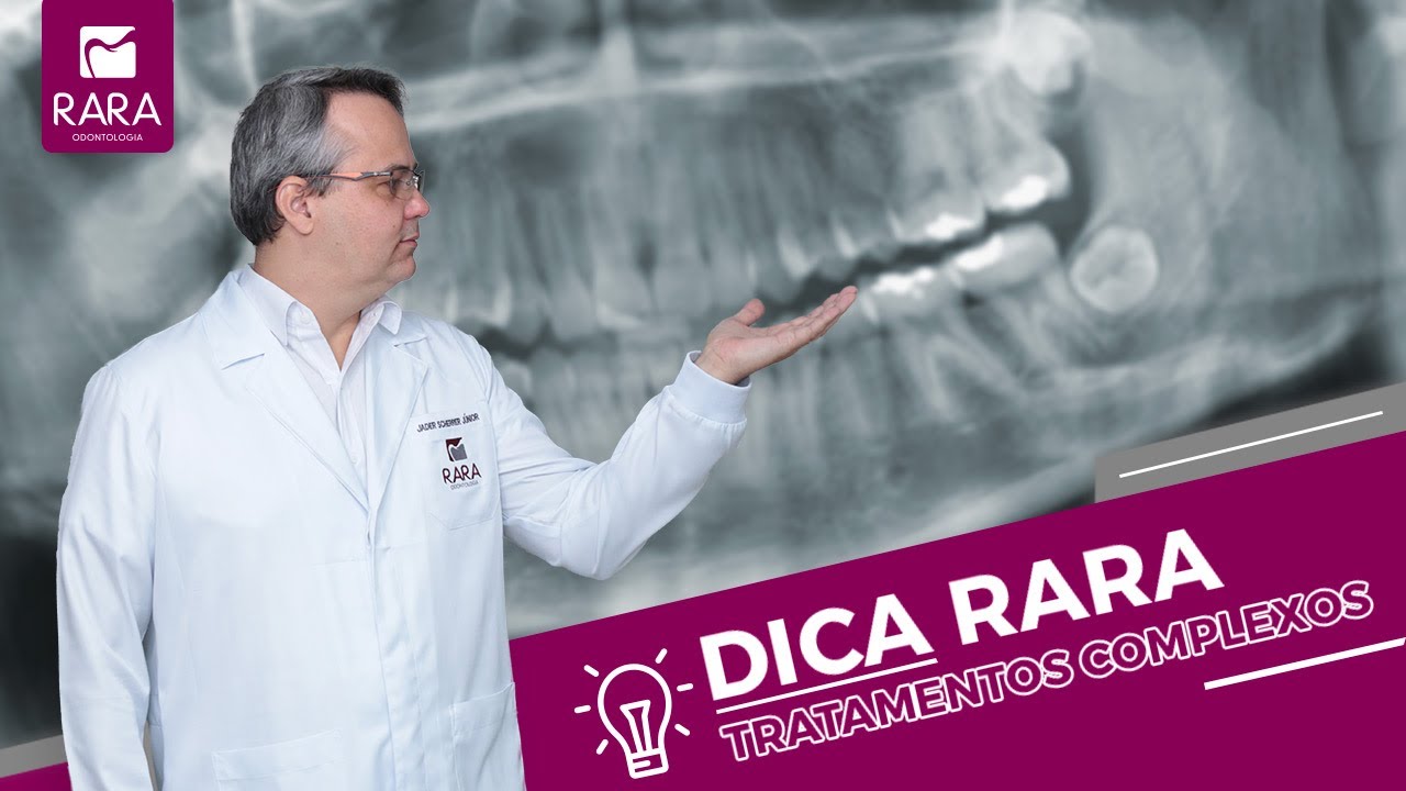 Passo a passo de um tratamento odontol&oacute;gico complexo