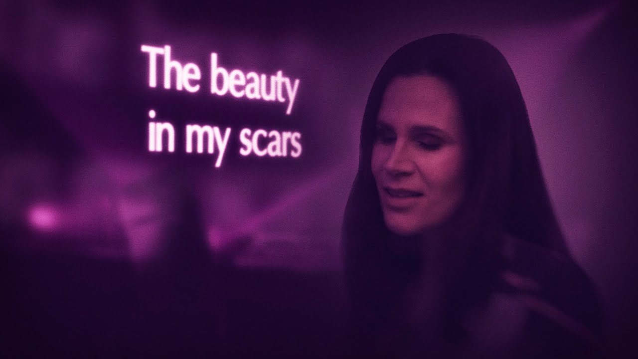 XiJaro & Pitch with Susana - Beauty In My Scars (Official Lyric Video)