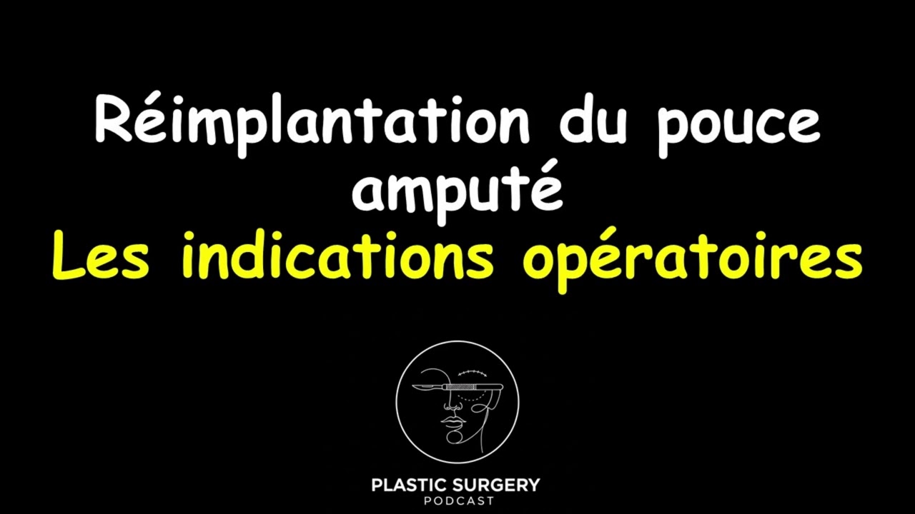 Réimplantation du pouce amputé : Les indications opératoires