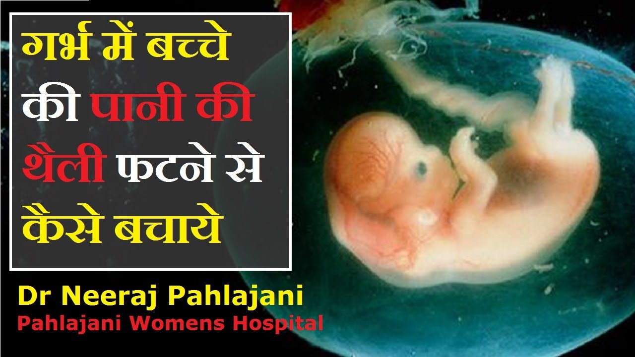 Water Bag Leakage In Pregnancy Symptoms - Amniotic Fluid Leak Treatment