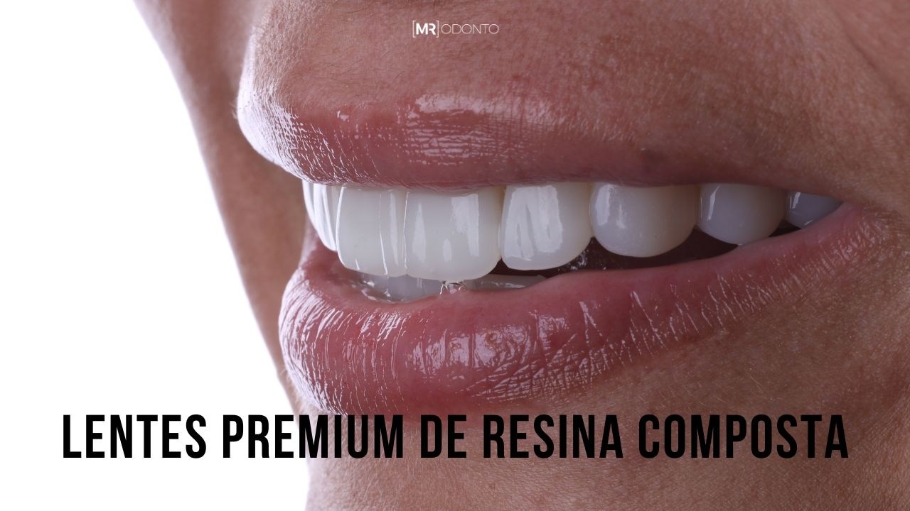 LENTES DE RESINA PREMIUM