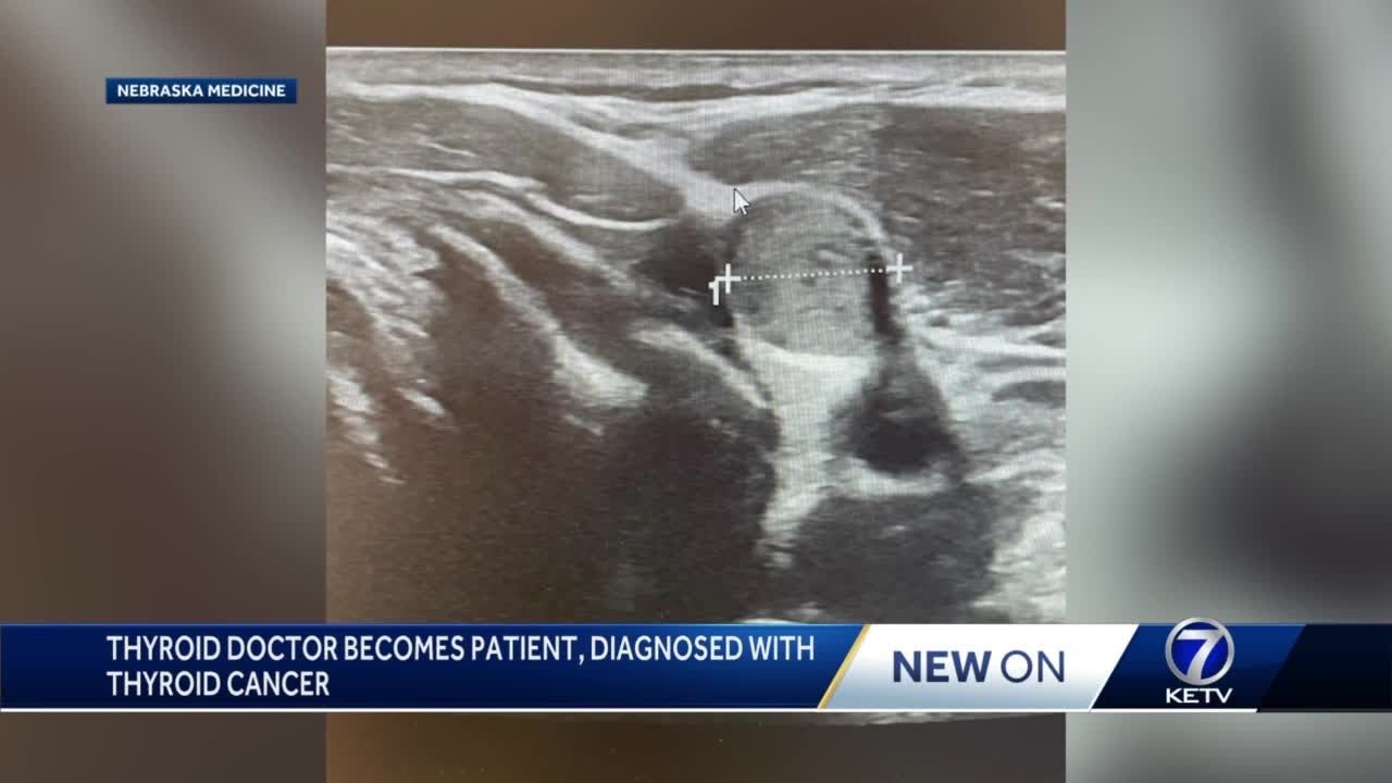 Endocrinologist becomes patient, diagnosed with thyroid cancer