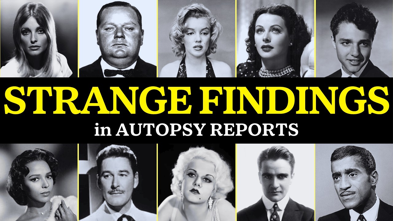 WEIRD Things Found In Celebrity Autopsy Reports (Golden Era Edition)
