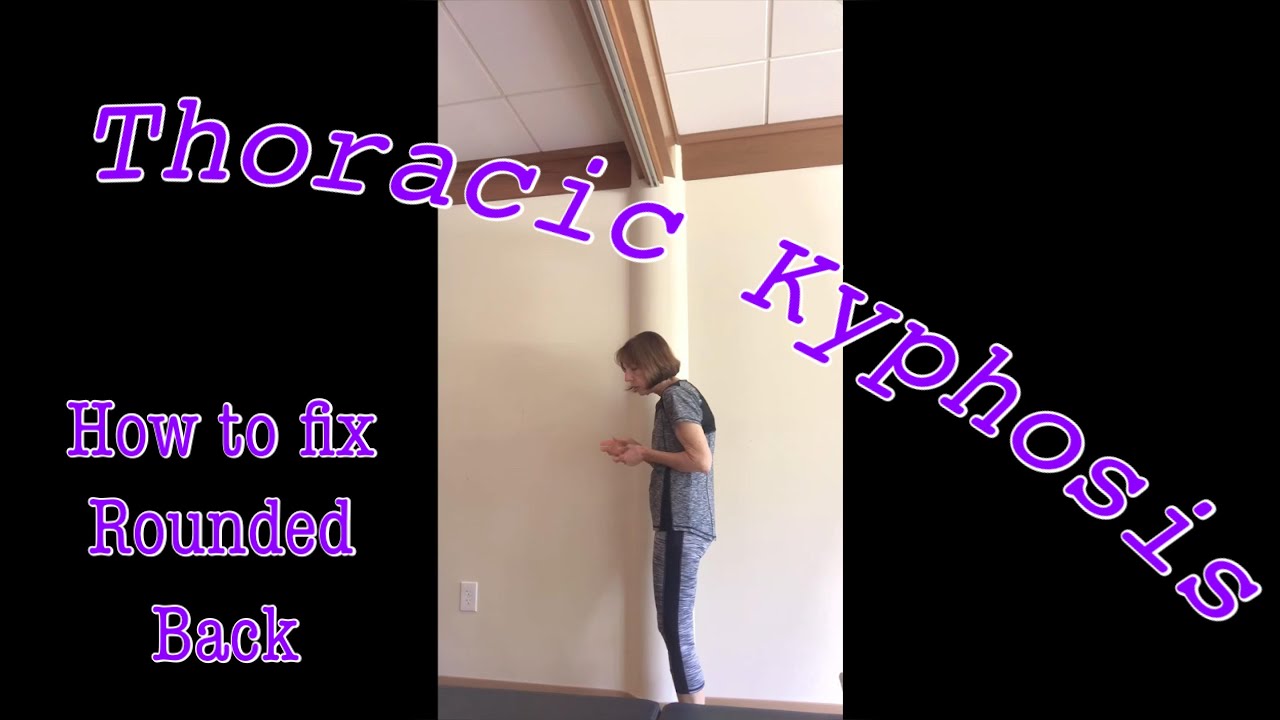 Thoracic Kyphosis or Rounded Back: Simple Things You Can do to Improve Your Posture