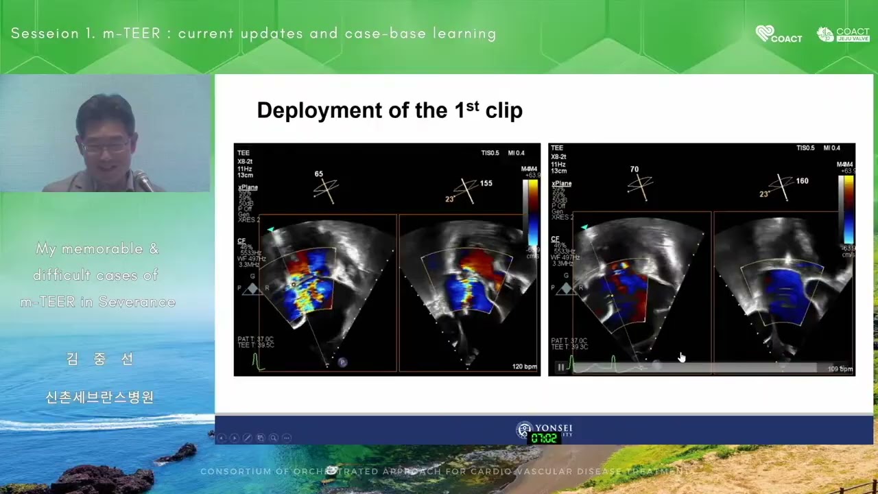 HALLA 2025 CJV 1-1 : My memorable & difficult cases of m-TEER in Severance 김중선
