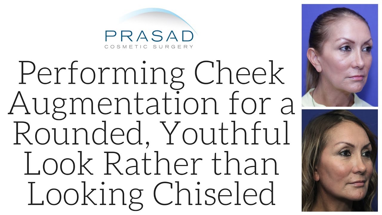 How Cheek Augmentation is Performed for a Youthful, Rounded Look, While Avoiding Looking Chiseled