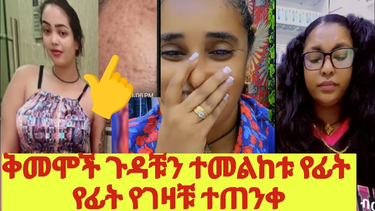 ትኩስ ዜና ያለ ሀኪም ትዛዝ ፊታቹን የምትጠቀሙት ክሬም ጉድ አፈላ 😳
