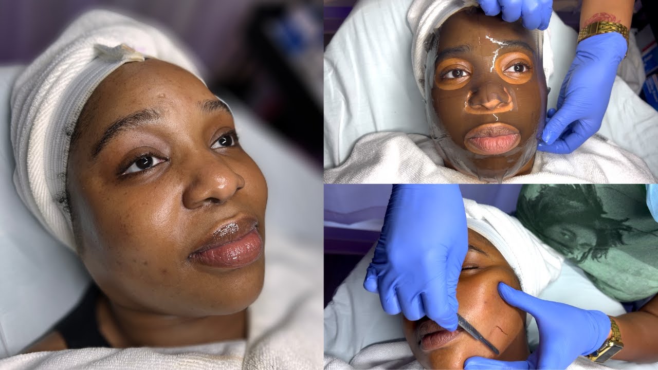 DERMAPLANING Facial | Bye-Bye Dead Skin + Hair