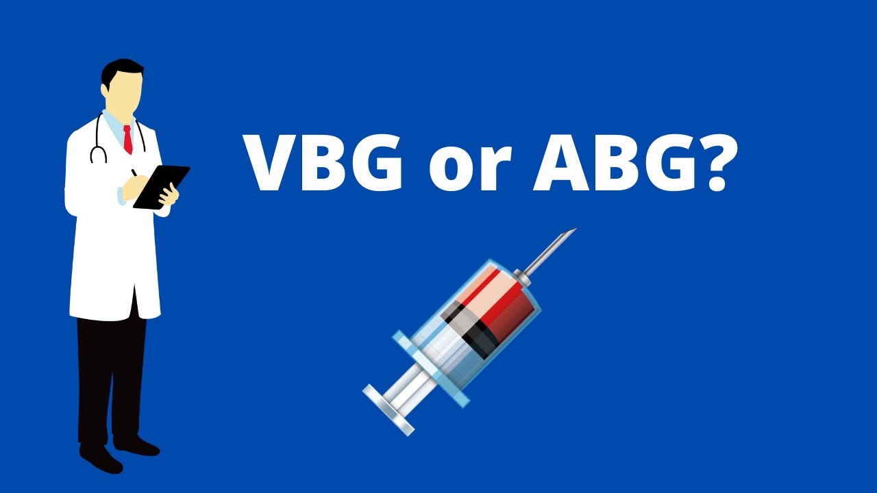 VBG или ABG? Какой заказать?