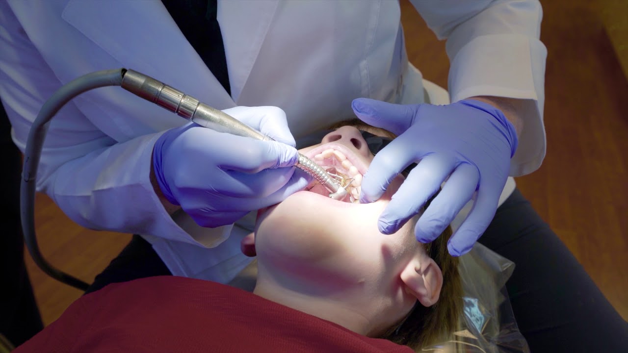 Expander Removal