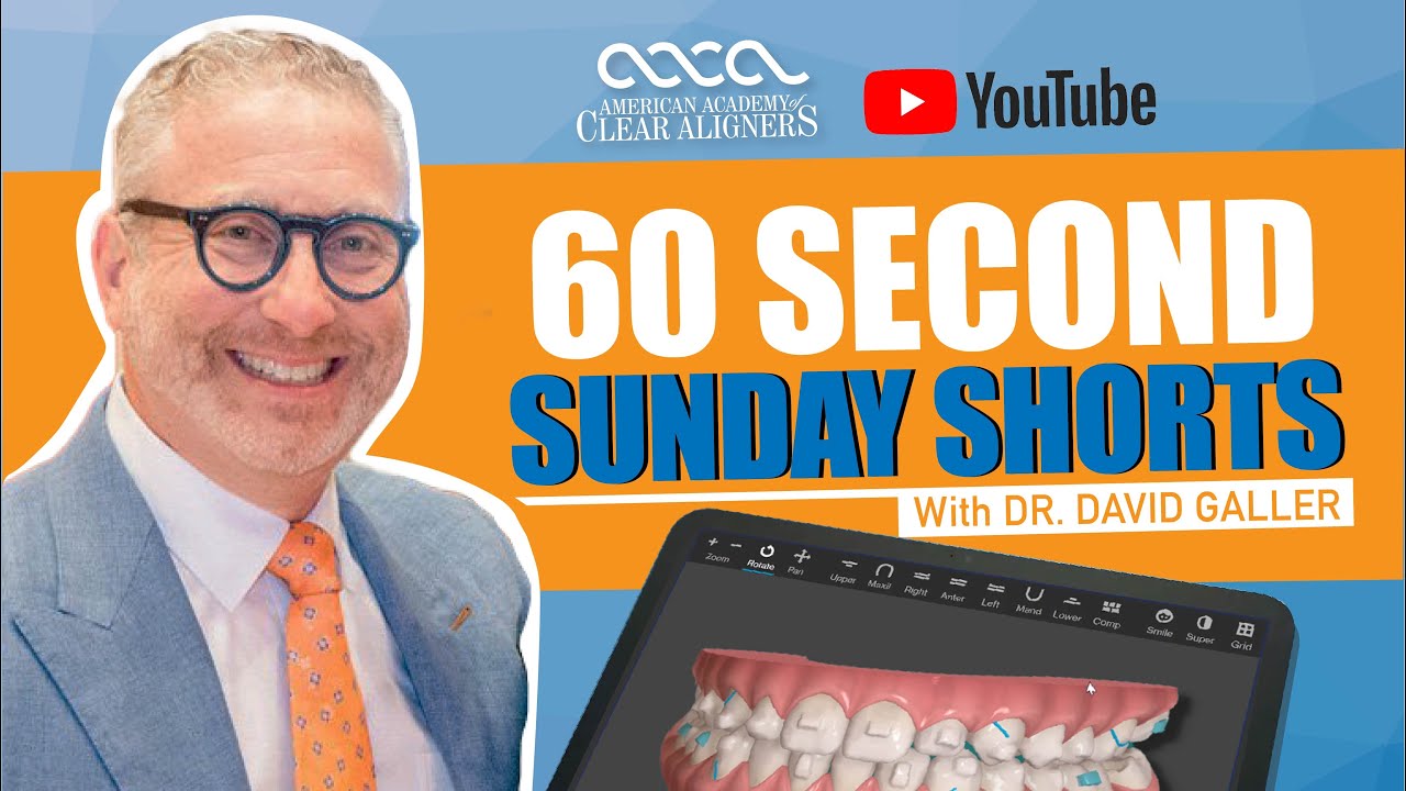 Laser Focus in Additional Aligners