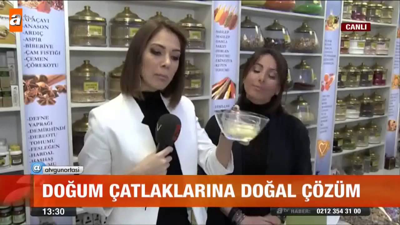 Doğum çatlaklarına doğal çözüm - atv Ana Haber