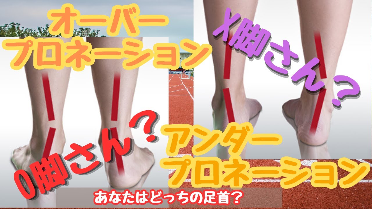 自分の足首変な角度？O脚・X脚が気になる人必見！偏ったプロネーション・サピネーションを見逃すな！痛みの原因を今すぐ解消