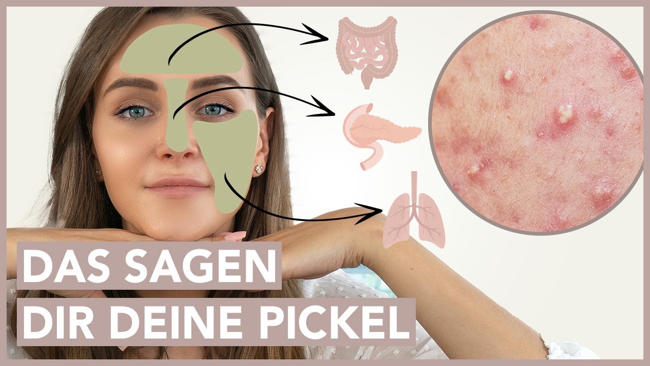 FACE MAPPING - was verraten Deine Pickel über Deine Gesundheit?