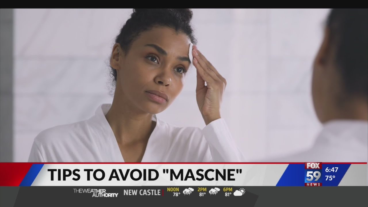 Tips to avoid mask acne