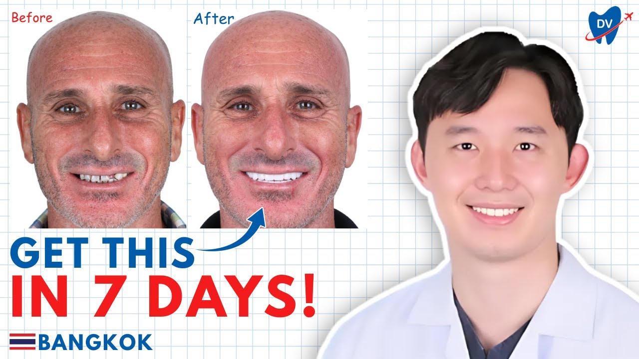 All-on-4 Dental Implants: Bangkok’s Top Dentists Reveal Cost, Process & Real Results!