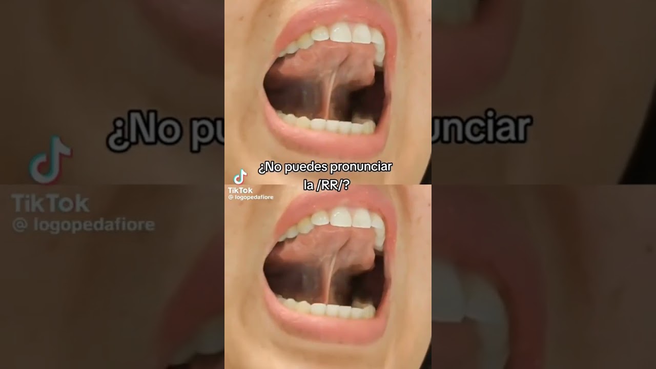 Video de los equipos multidisciplinarios 