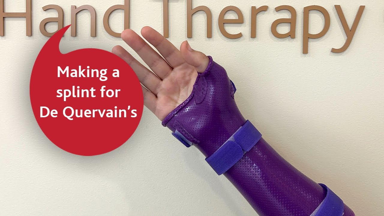 Making splint for DeQuervains Tenosynovitis