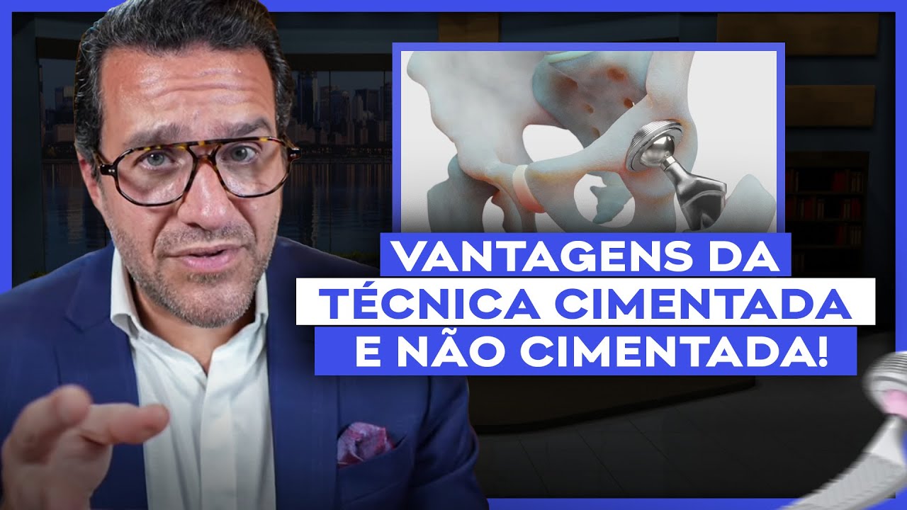 Vantagens da t&eacute;cnica cimentada e n&atilde;o cimentada! Qual a diferen&ccedil;a? Pr&oacute;tese Total de Quadril