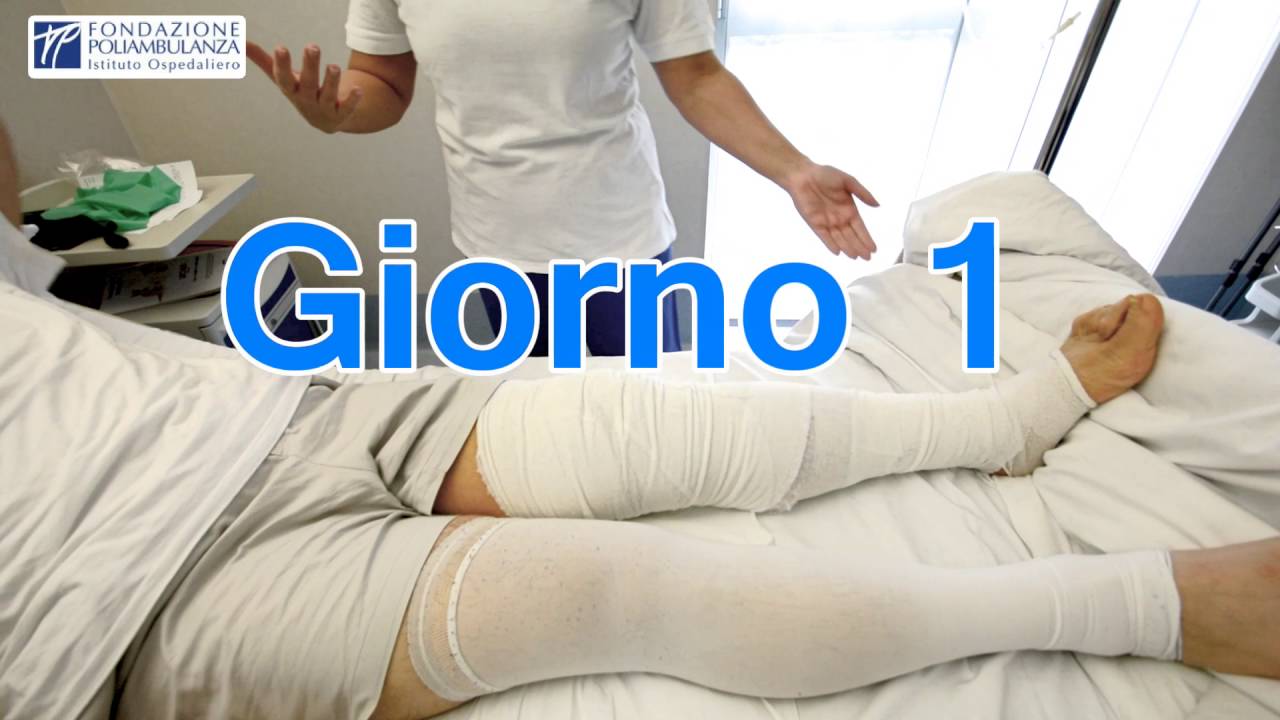Trattamento fisioterapico protesi ginocchio