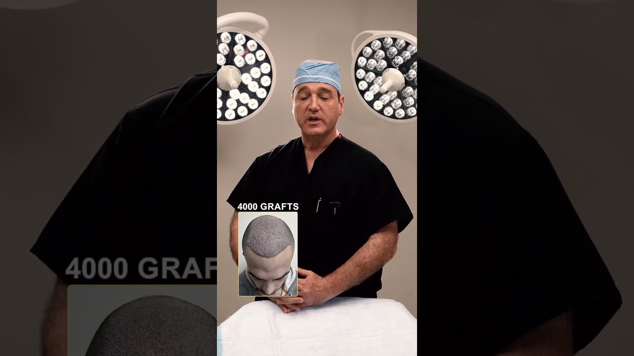 Q&A: Why is my hair falling out after the surgery?