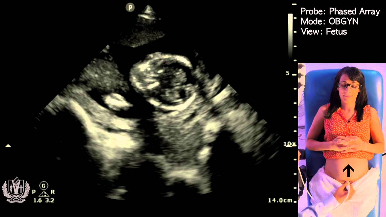 Obstetric Ultrasound Basics with Fetal Heart Rate Calculation​ - Made Simple
