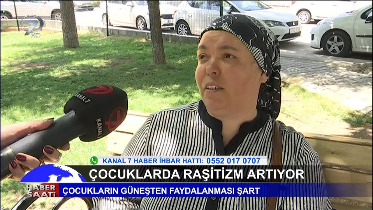 &Ccedil;ocuklarda Raşitizm Artıyor!