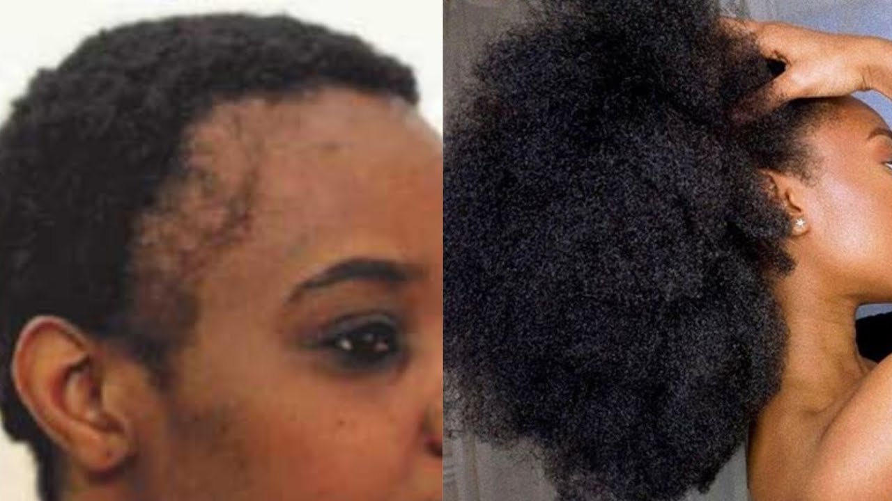 10 choses qu'il faut faire pour &eacute;viter la casse de ses cheveux crepus.