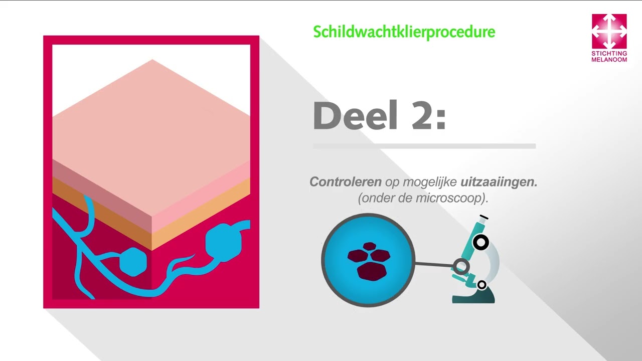 Diagnose stadium 3 melanoom deel 1