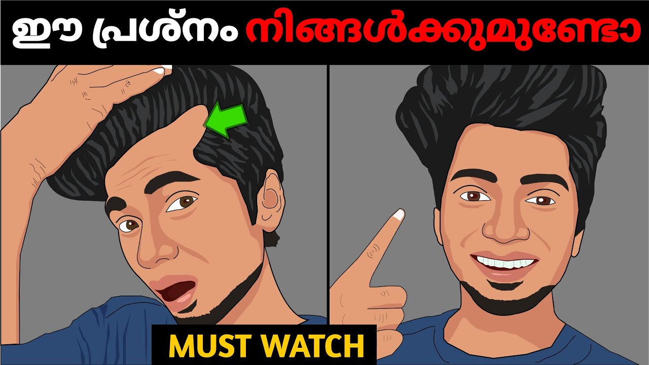 16-29 പ്രായക്കാരുടെ ഏറ്റവും വലിയ പ്രശ്നം😣7 WAYS TO STOP HAIR FALL *NATURALLY* REGROWHAIR ||HAIR FALL