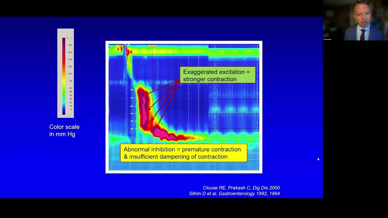 Esophageal Motility Testing in 2024