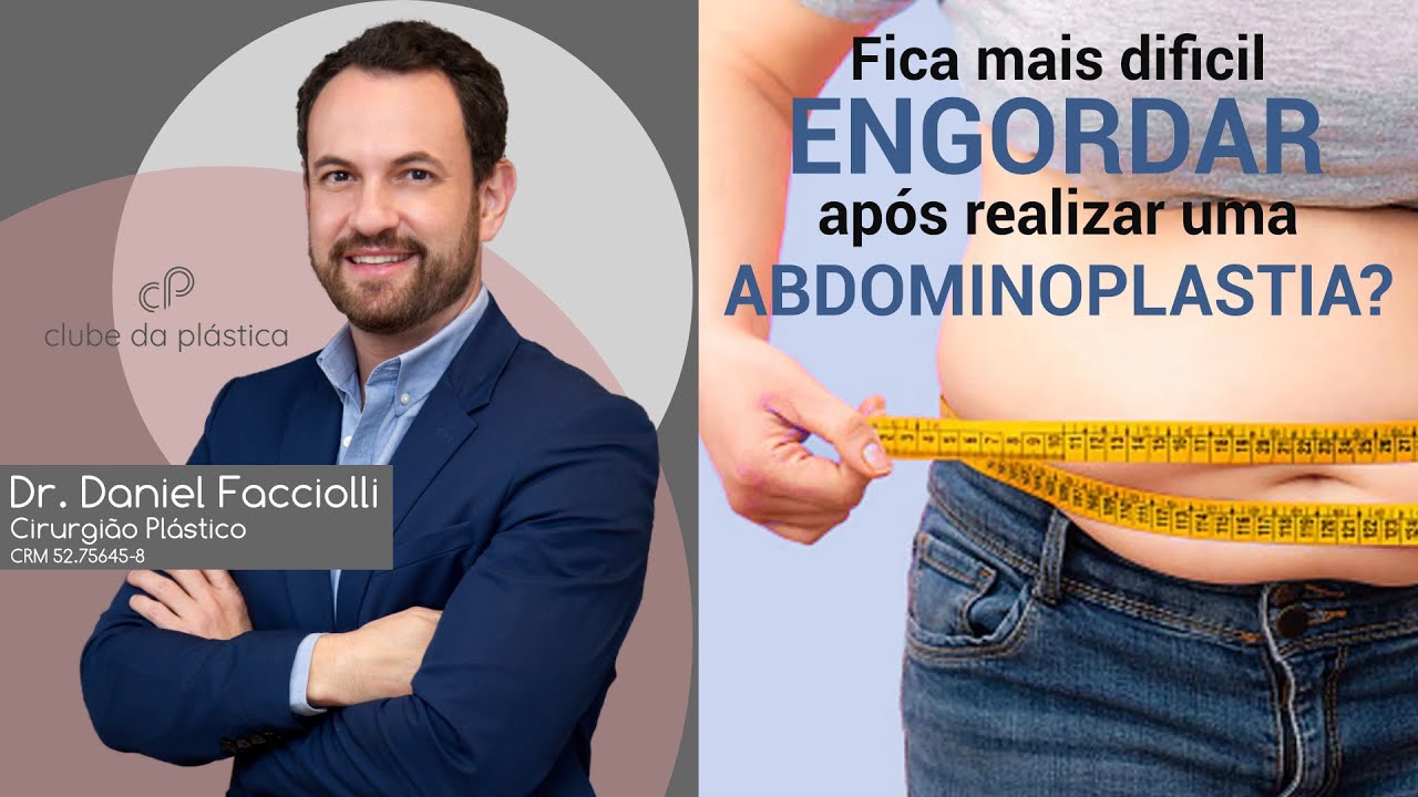 Clube da Plástica: Fica mais difícil engordar após realizar uma abdominoplastia?