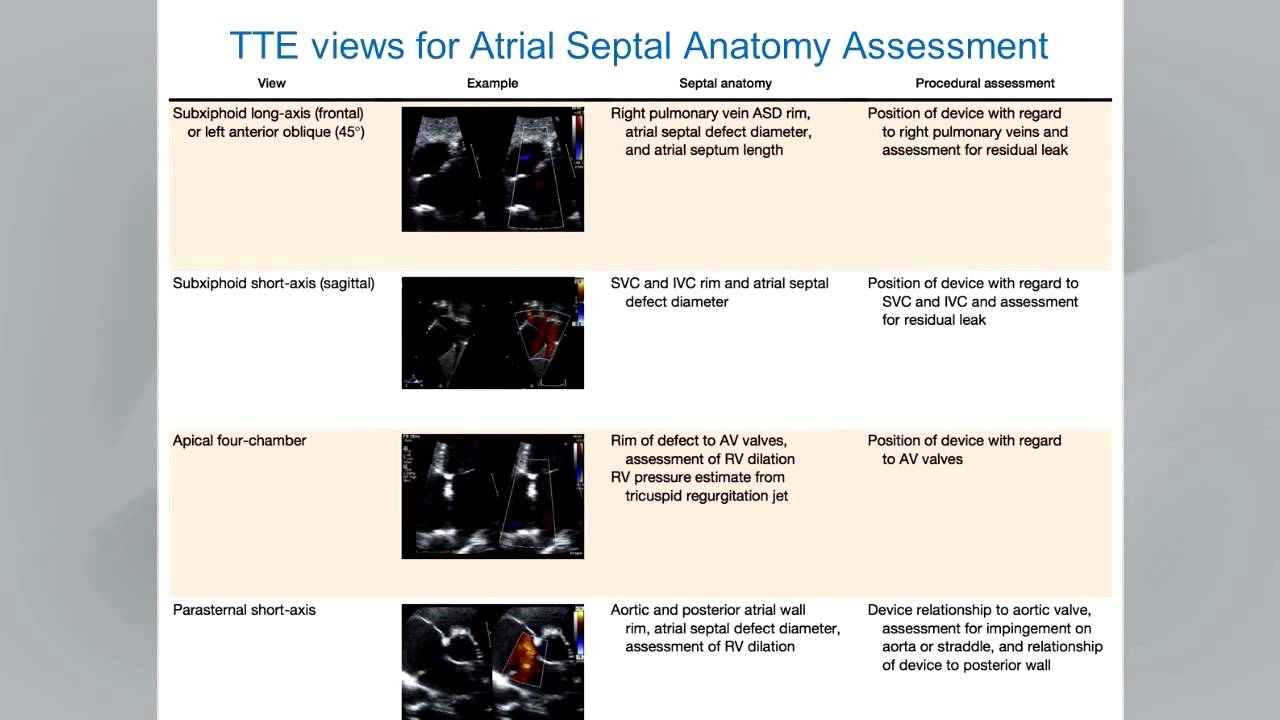Guidelines for the Echocardiographic Assessment of Atrial Septal Defect & Patent Foramen Ovale