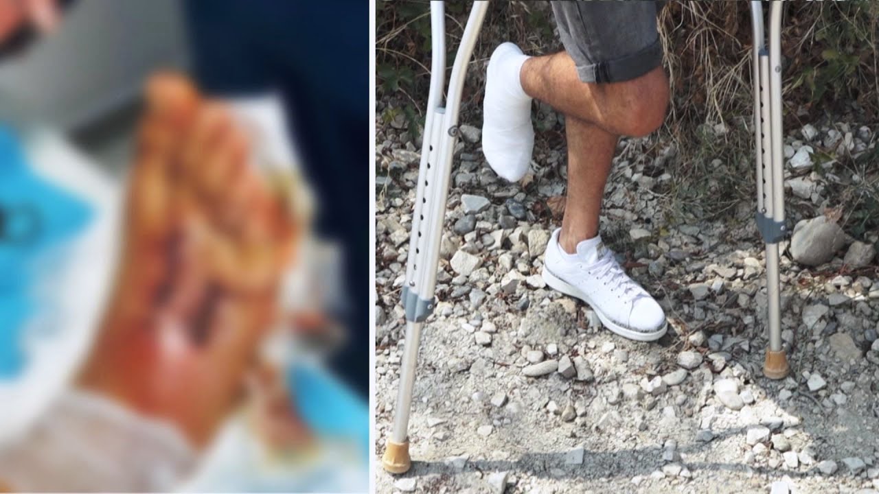 Fiks Fare/ Aksidentohet në punë, firma fsheh ngjarjen. OPGj: Hiq kallëzimin, merr lekët!