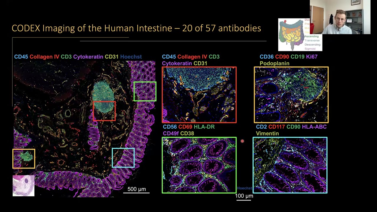 From Molecules to Multicell Modules: Immune-Mediated Tissue Restructuring