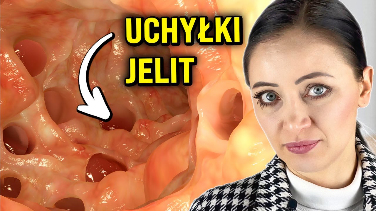 To są uchyłki jelit. 10 sposb&oacute;w, jak im zapobiec
