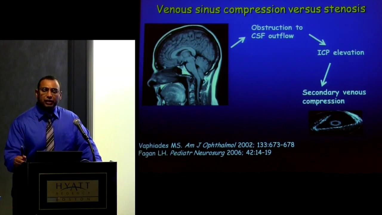 CSF Colloquium: Venous Anomalies Common in Arnold Chiari Malformation