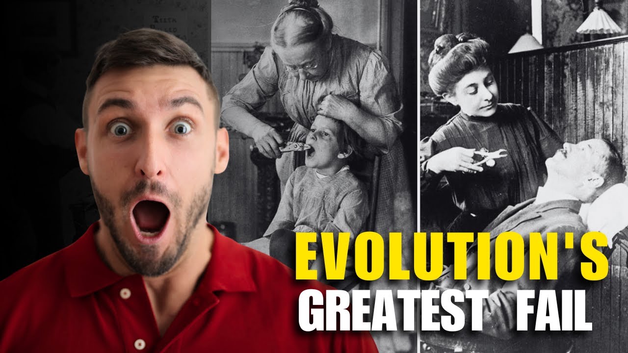 Why Wisdom Teeth Are Evolution's Biggest Fail
