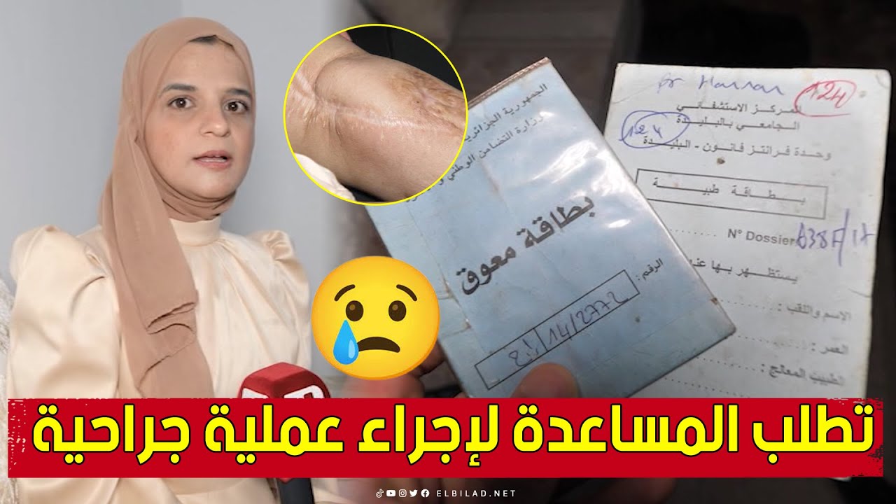 #نـاديـة من #الأغواط.. تناشد المحسنين مساعدتها لإجراء عملية جـ.ـراحية.. شاهد: