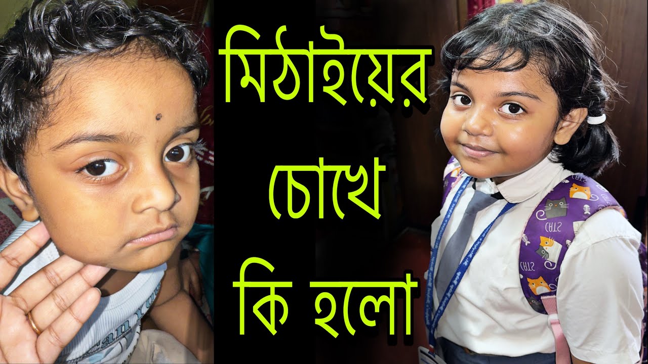 মিঠাইয়ের চোখে কি হলো 👀🤔❤️🧿 #mistu #mithai #dailyvlog @bakambakam106 