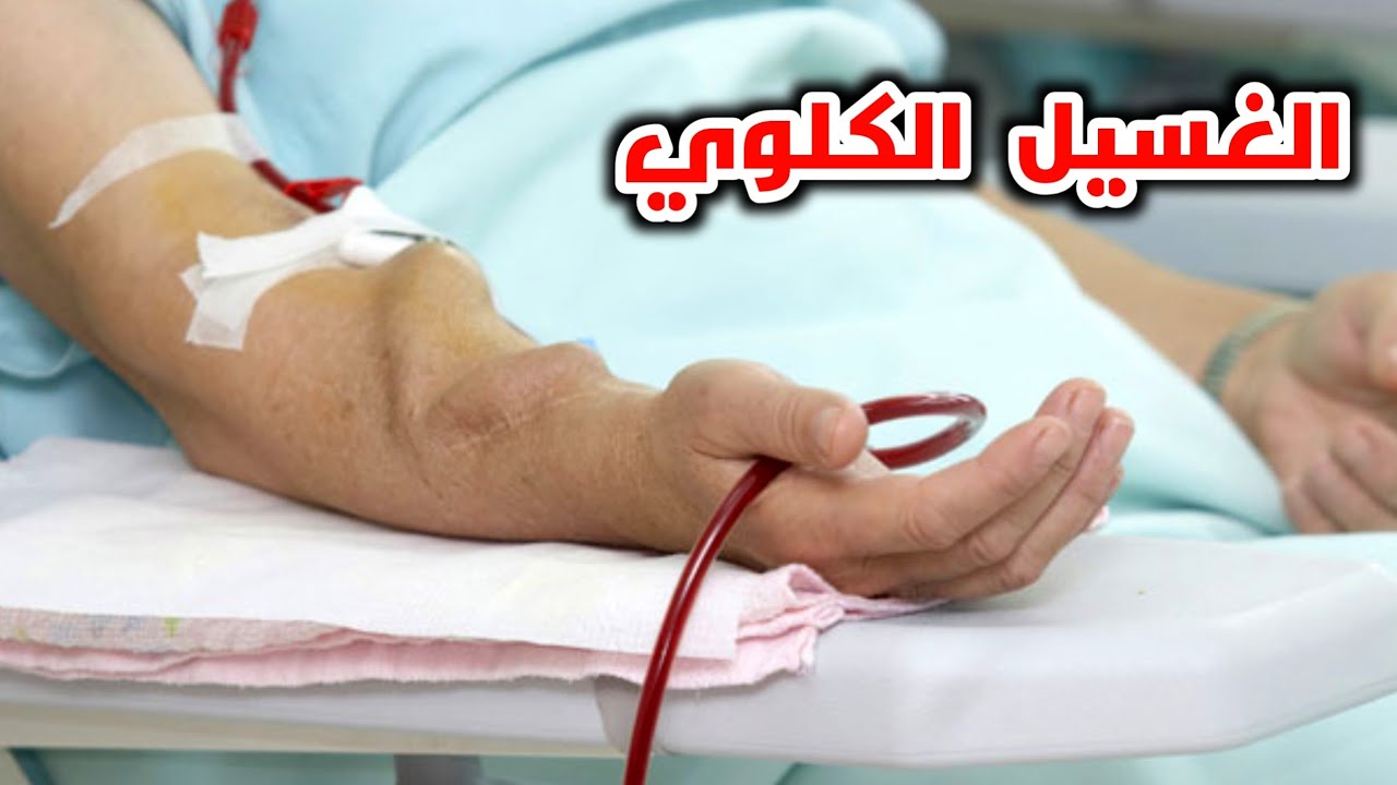 ما هو الغسيل الكلوي؟! وماذا يحدث اثناء جلسة الغسيل _ ?What is dialysis