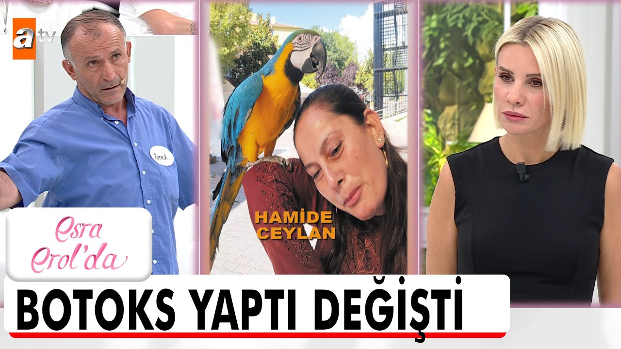 Karım botoks yaptırınca sosyal medyadan çıkmaz oldu! - Esra Erol'da 8 Eylül 2025