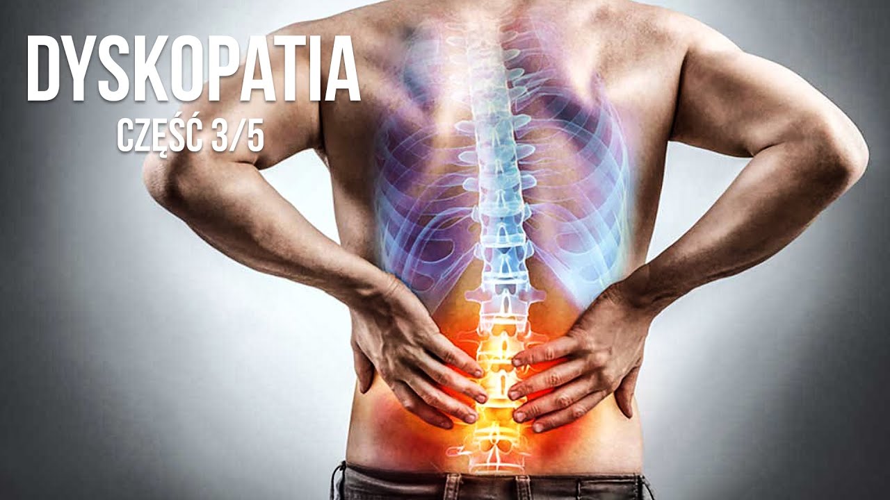 POSTĘPOWANIE U KLIENTA Z DYSKOPATIĄ 3/5