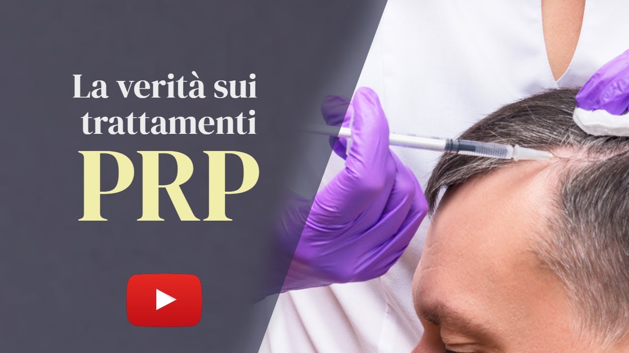 Trattamento PRP capelli [Fermare la perdita di capelli per sempre?]