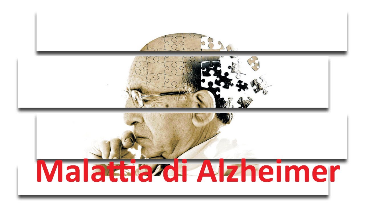 FERDINANDO NICOLETTI: Neurobiologia della Malattia di Alzheimer