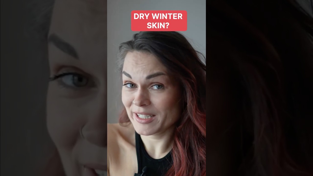 WINTER IS AGING YOUR FACE!