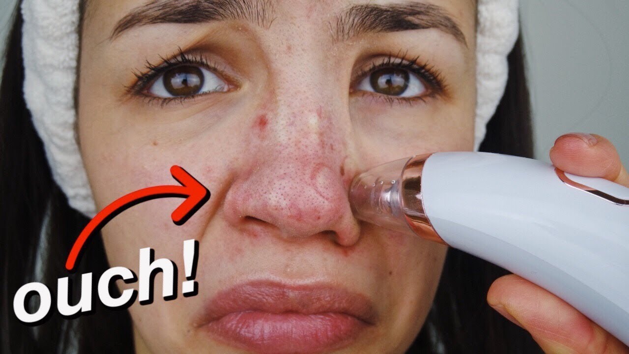 PORE + BLACKHEAD REMOVER VACUUM! *UP CLOSE FOOTAGE*